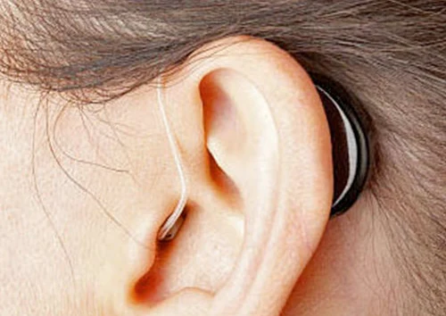 Appareils auditifs micro-contours